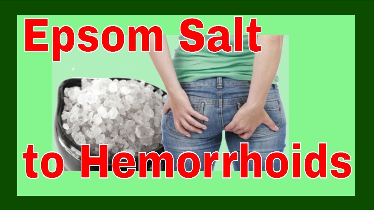 Hemorrhoids Treatment