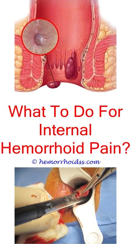 hemorrhoidsstreatment can hemorrhoids affect getting into ...