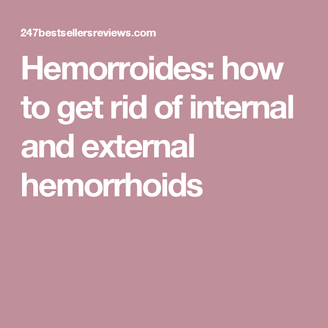 Hemorroides: how to get rid of internal and external hemorrhoids ...