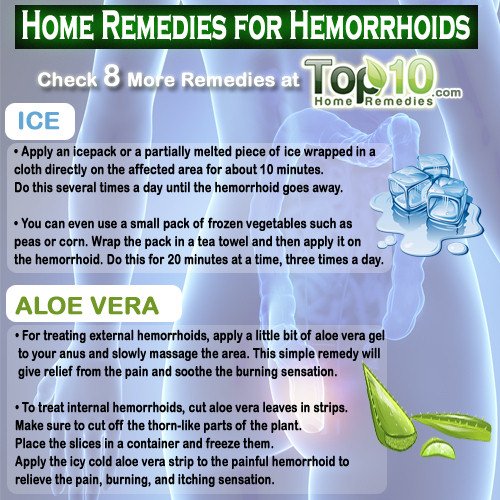 Home Remedies for Hemorrhoids (Piles)