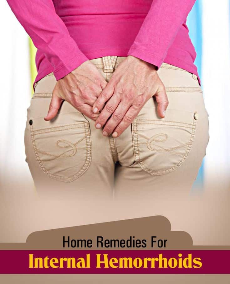 Home Remedies for Internal Hemorrhoids