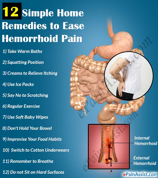 Home Treatment For Hemorrhoids Pain