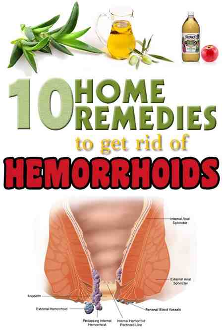 Homeopathic Remedies For Hemorrhoids Swelling In Hands ...