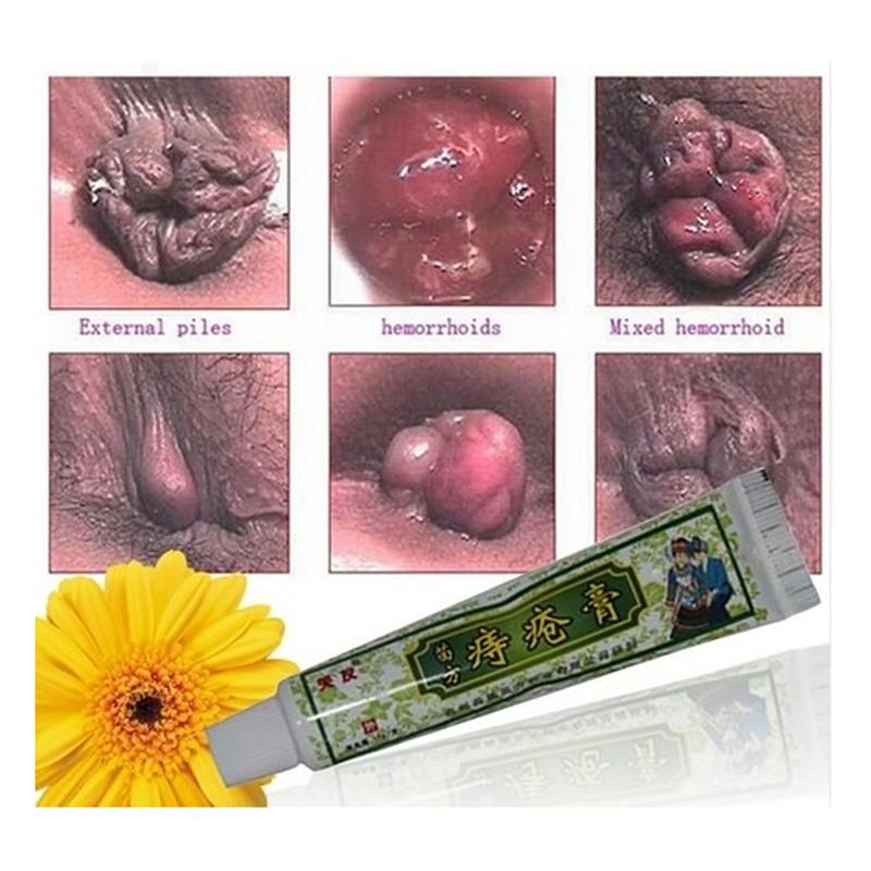 Hot 15g Hemorrhoids External Mixed Healthy Treatment Cream with Outer ...