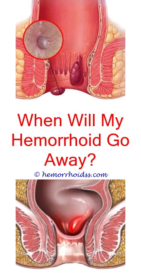 How Can You Get Rid Of Hemorrhoids?