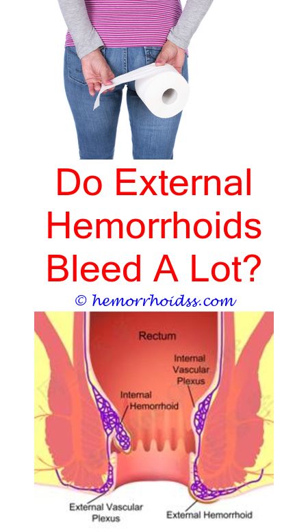 How Do Doctors Check For Hemorrhoids?