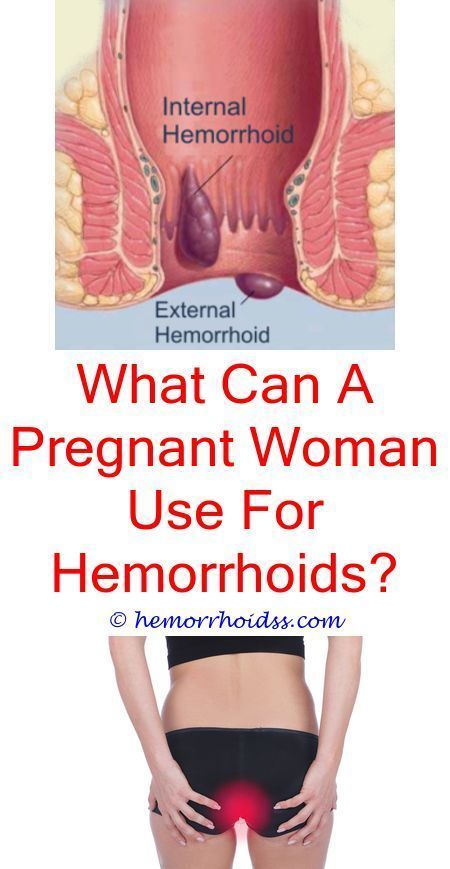 How do i make my hemorrhoid stop bleeding?.How to help ...