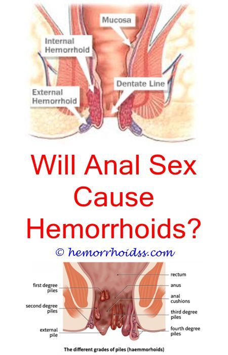 How Does Excercising Improve Hemorrhoid? can you drink ...