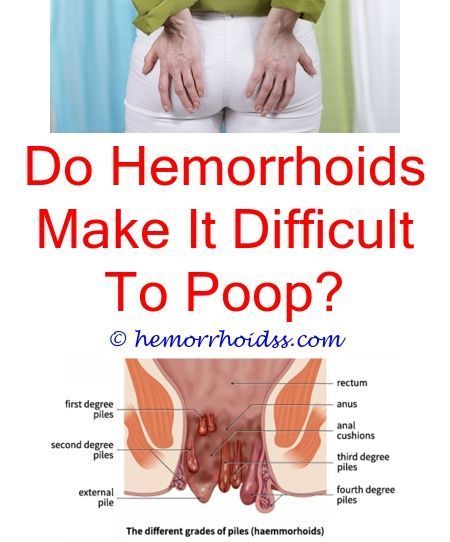How long can hemorrhoids last if untreated?.Can tucks pads help ...