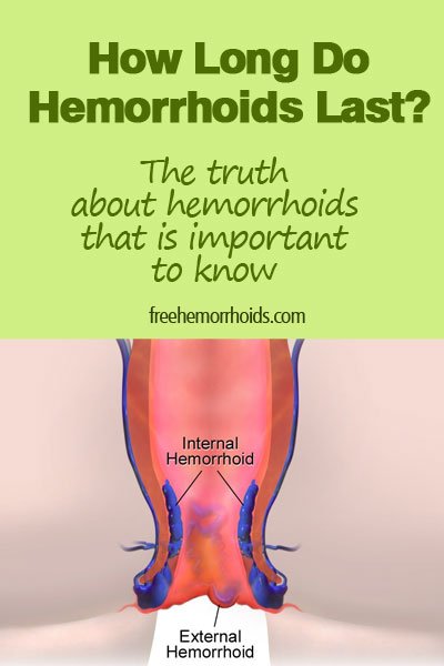 How Long Do Hemorrhoids Usually Flare Up Pain Last ...