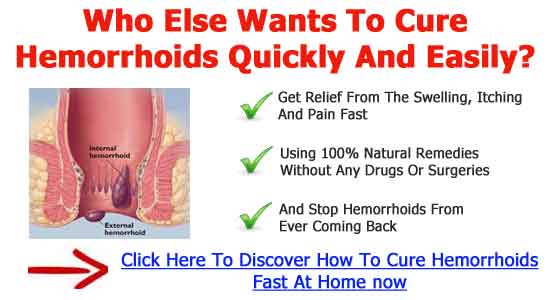 How To Cure Hemorrhoids Fast At Home â 11 Easy Ways