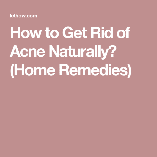 How to Get Rid of Acne Naturally? (Home Remedies)