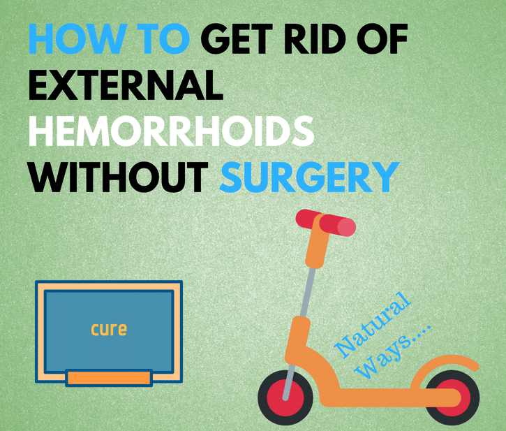 How to get rid of external hemorrhoids without surgery