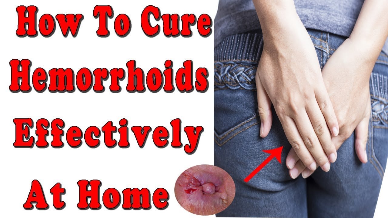 How to Get Rid of Hemorrhoids Fast and safe at home ...
