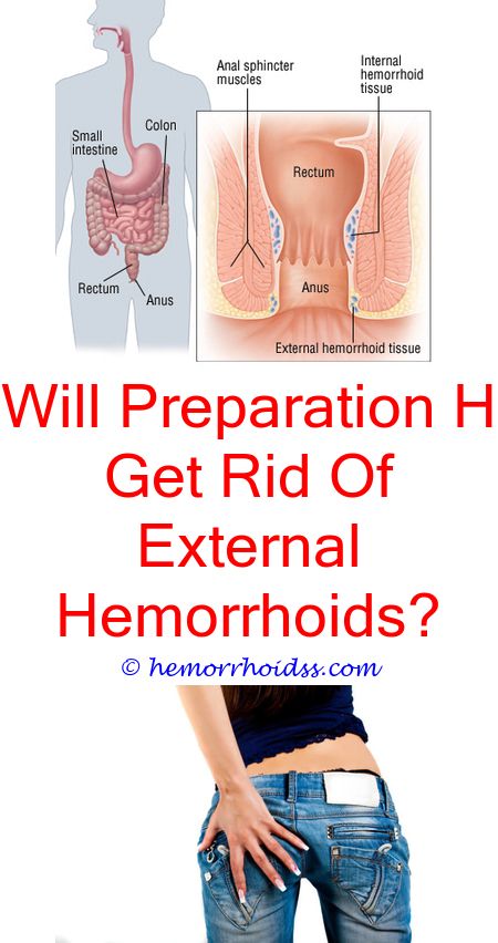 How To Get Rid Of Hemorrhoids On A Baby? how long to heal internal ...