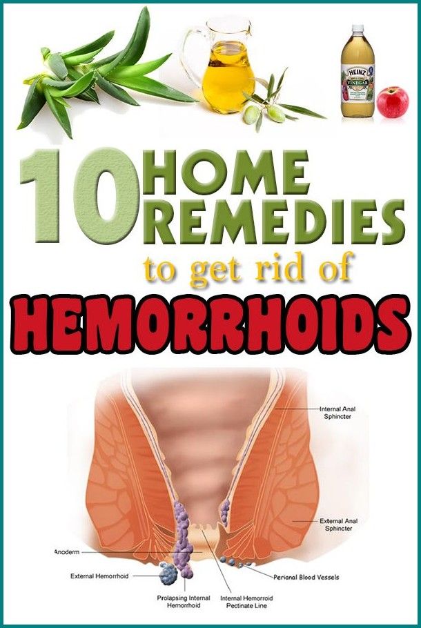 How to Get Rid of Hemorrhoids without Surgery in 2020 ...