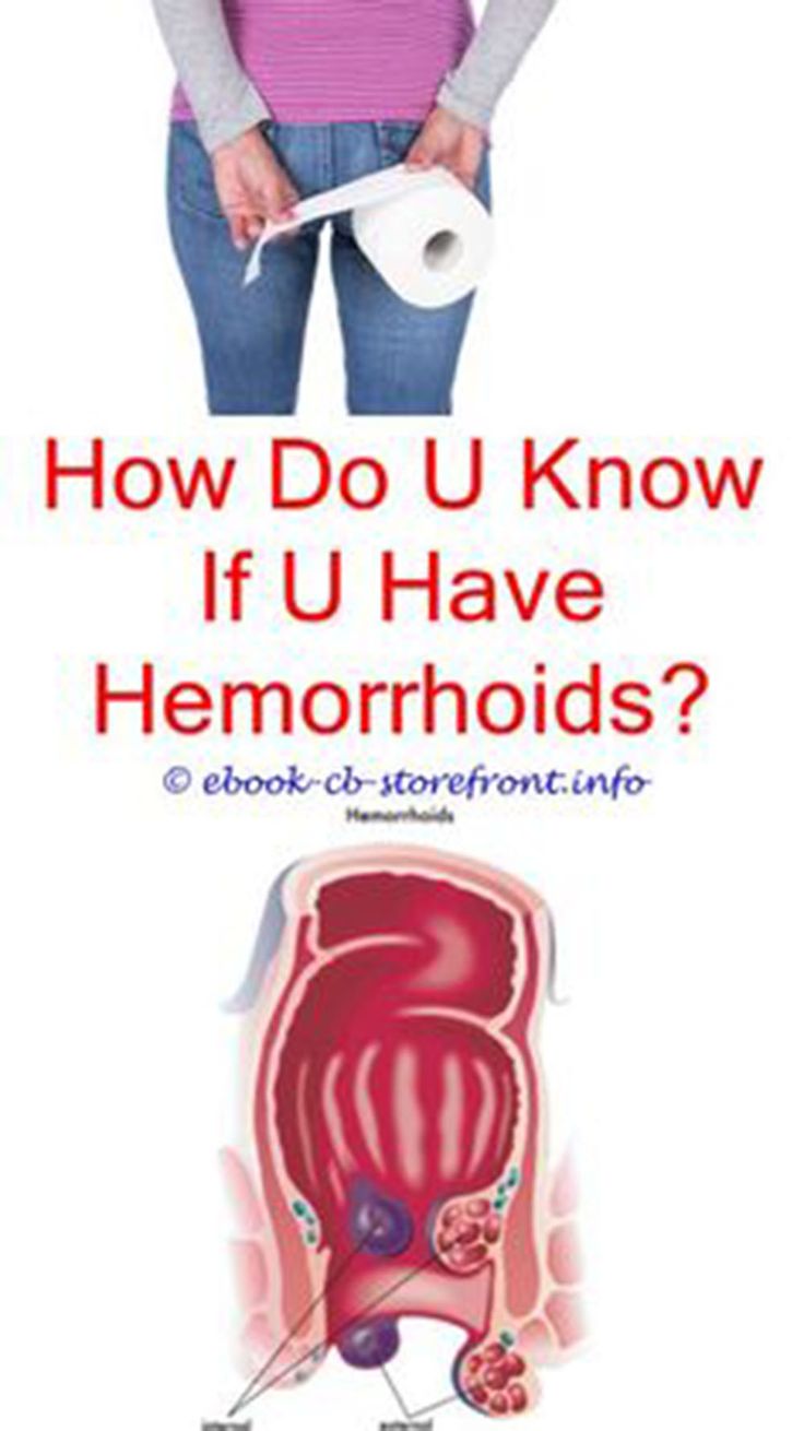 How to get rid of internal hemorrhoids