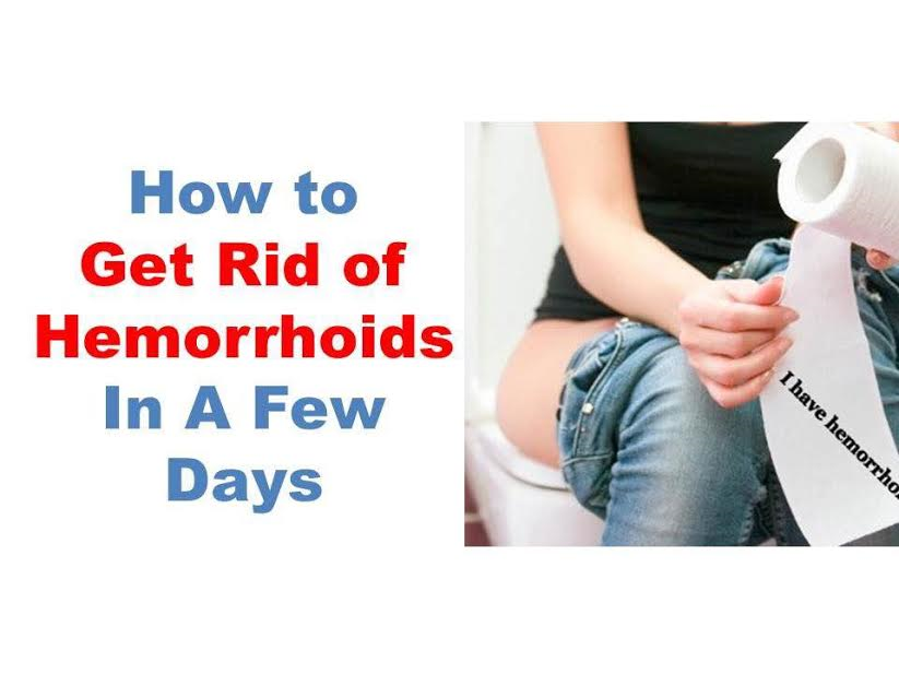 How to get rid of piles [Hemorrhoids] in a few days ...