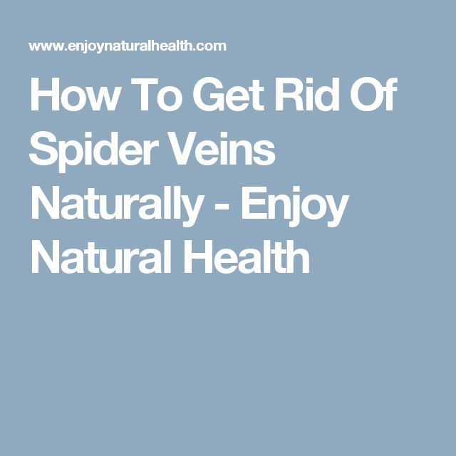 How To Get Rid Of Spider Veins Naturally