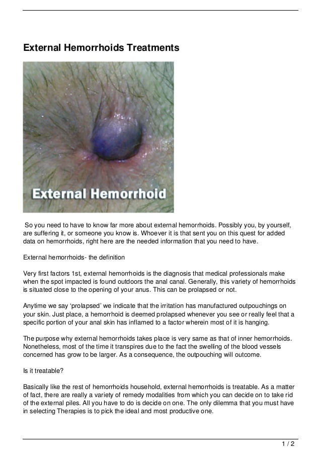 How to inform when you have Hemorrhoids