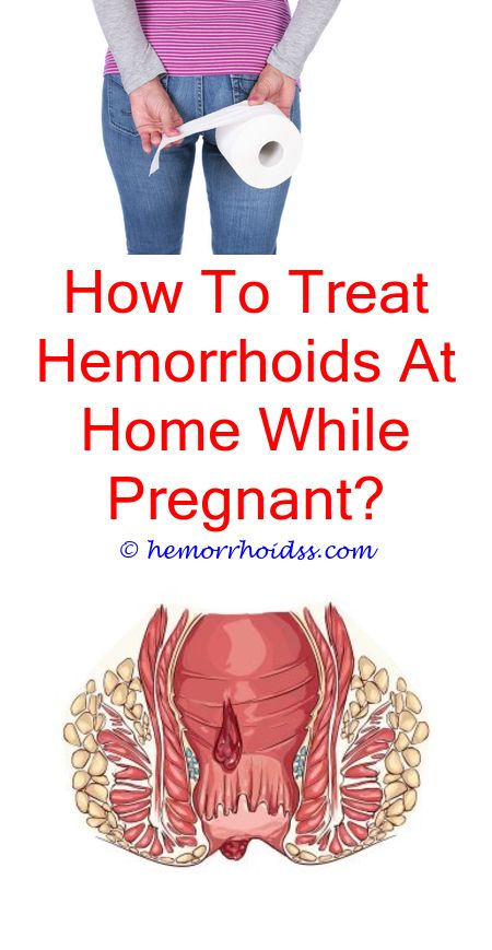 How To Shrink Hemorrhoids At Home?