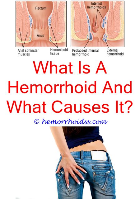 How To Treat Bleeding From Hemorrhoids? why are ...