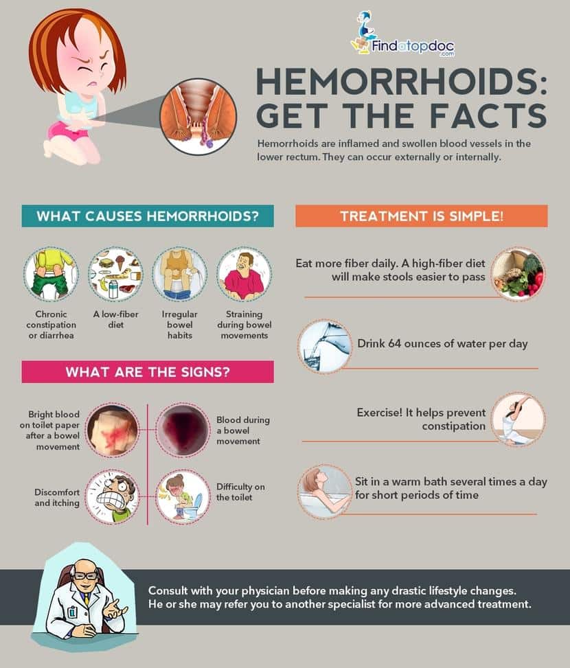 How To Treat External Thrombosed Hemorrhoids