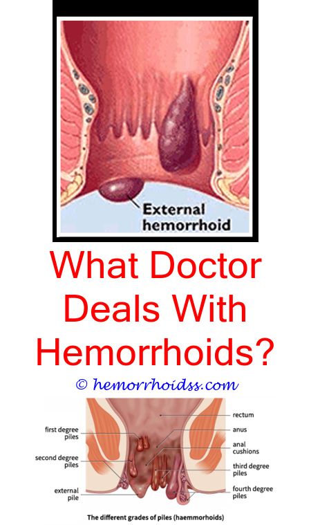 How To Treat Grade 3 Hemorrhoids  ho.modulartz.com
