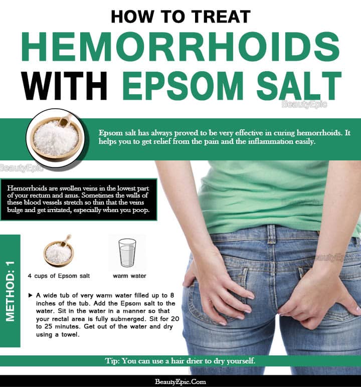 How to Use Epsom Salt to Relieve Hemorrhoids?