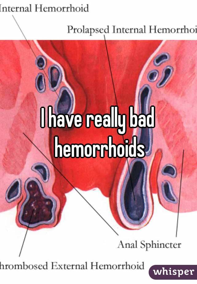 I have really bad hemorrhoids