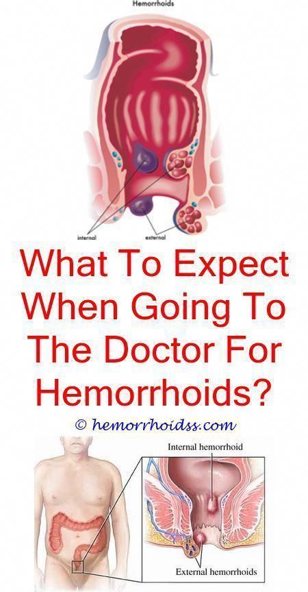 If you recognize why hemorrhoids happen and also what they are, it is ...