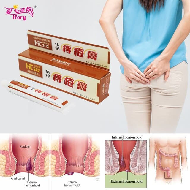 Ifory Chinese Patch Hua Tuo Hemorrhoids Ointment Sterilize Cream For ...