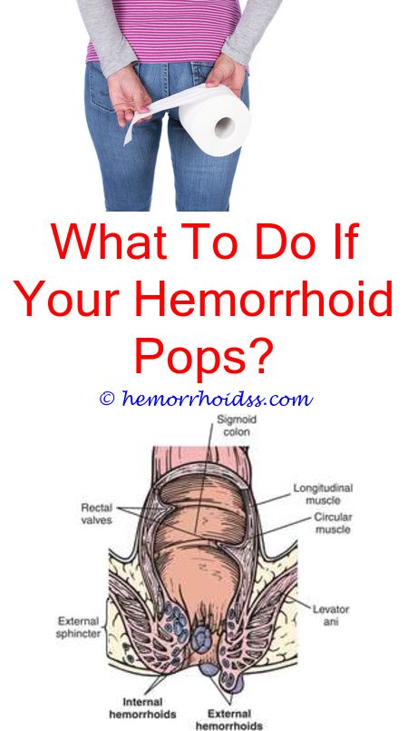 Incredible Useful Ideas: Do Hemorrhoids Itch And Burn? can ...