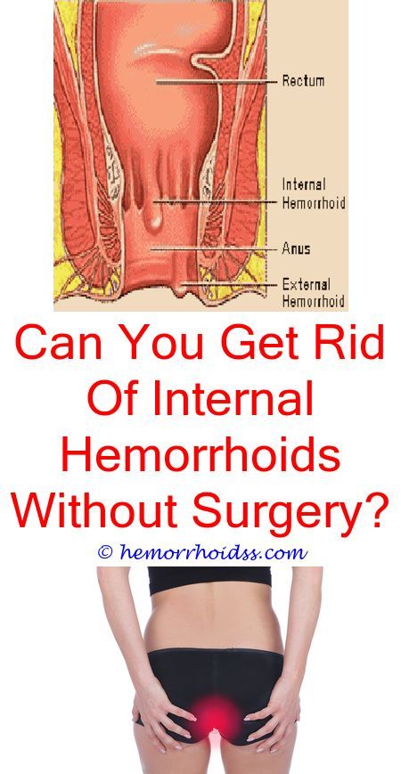 Is hemorrhoids deadly?.Can you get hemorrhoids from ...