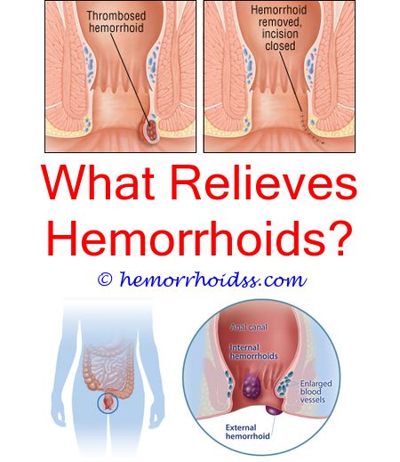 Is It Normal For Hemorrhoids To Bleed?