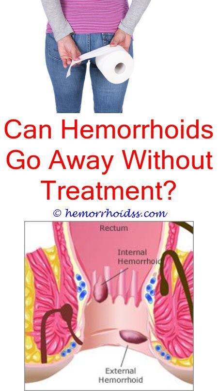 Jolting Tips: Can You Use Monistat On A Hemorrhoid? where do you put ...