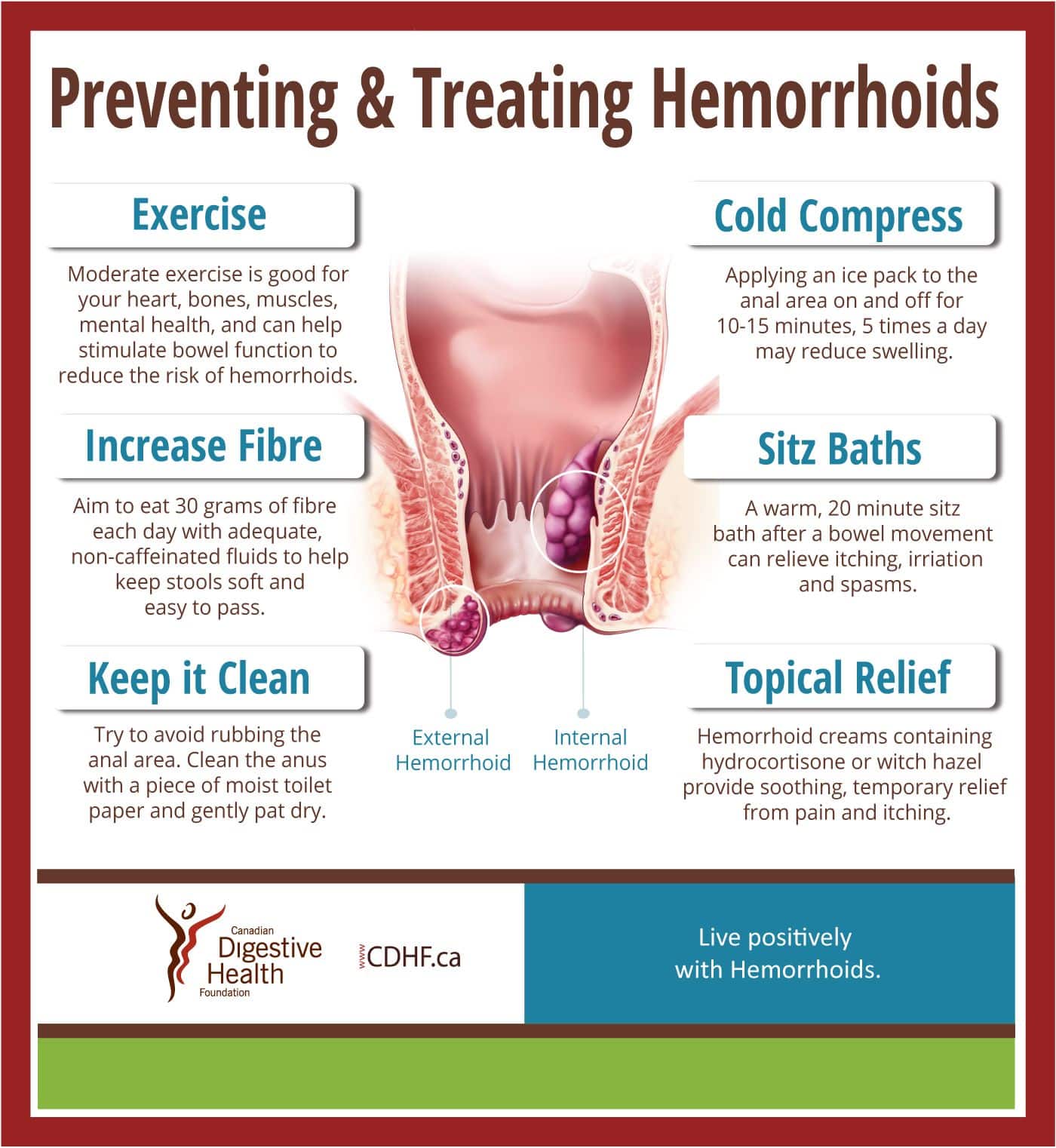 NEW HEMORRHOIDS EDUCATION GUIDE #Hemorroids are one of the most common ...