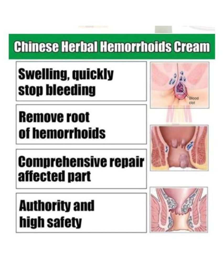pain refief cream Hemorrhoids &  Piles Hemorrhoids Ointment Powerful ...