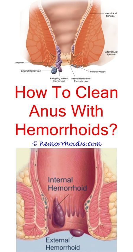 Picture Of Dog Hemorrhoids