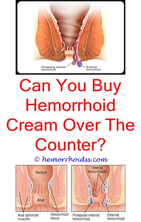 #piles how to reduce hemorrhoids?