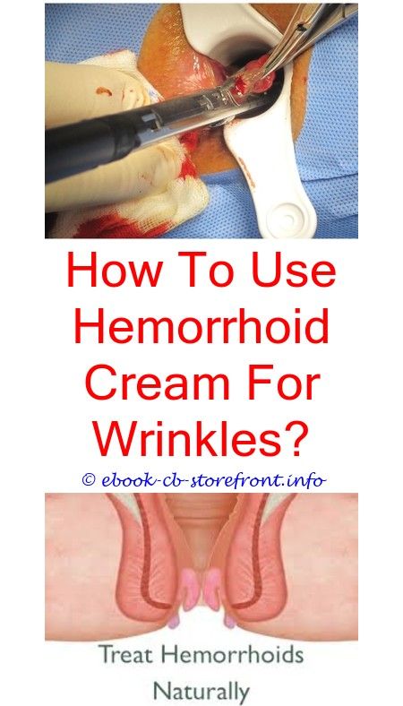 Pin on Hemorrhoid Causes And Cure