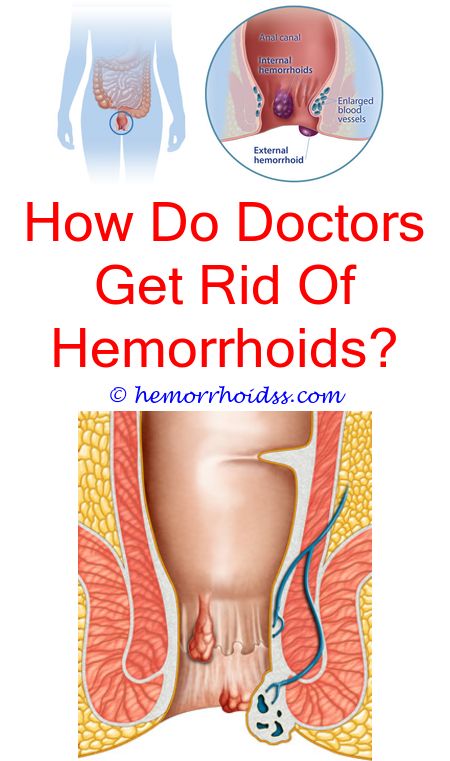 Pin on How To Get Rid Of Hemorrhoids Naturally