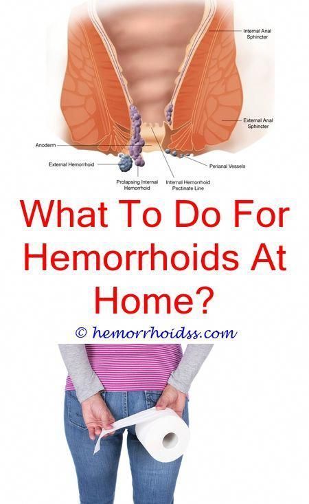 Pin on The Hemorrhoids Guide