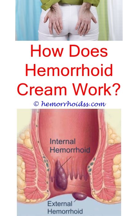 Portentous Cool Tips: How To Remove Hemorrhoids Naturally? will a warm ...