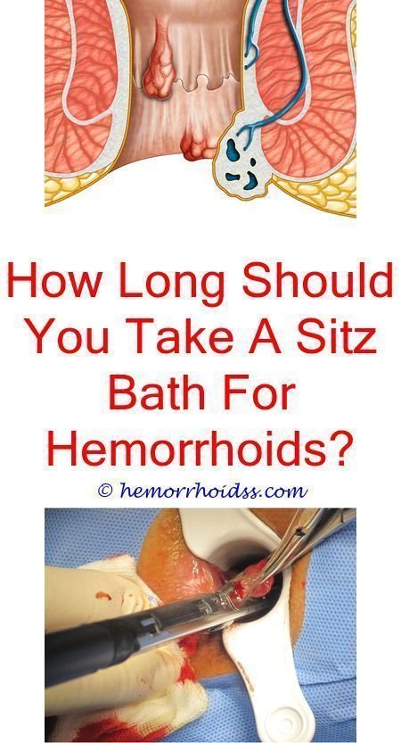 Recognizing exactly what a hemorrhoid is, will certainly go a very long ...