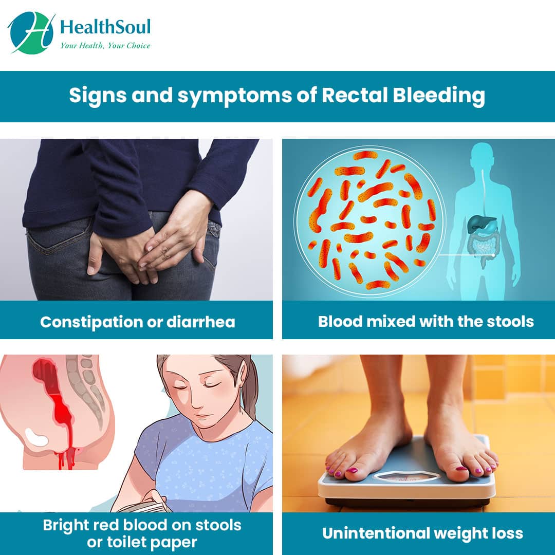 Rectal Bleeding: Causes and Treatment â Healthsoul
