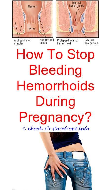 Stupendous Cool Tips: Can Hemorrhoids Cause Perineum ...