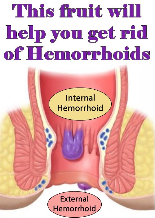 This fruit will help you get rid of Hemorrhoids