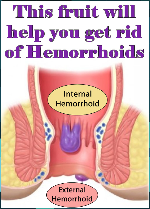 This fruit will help you get rid of Hemorrhoids in 2020 ...