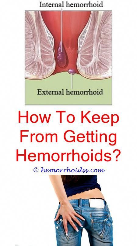 Thrombosed External Hemorrhoid Pictures / Internal ...